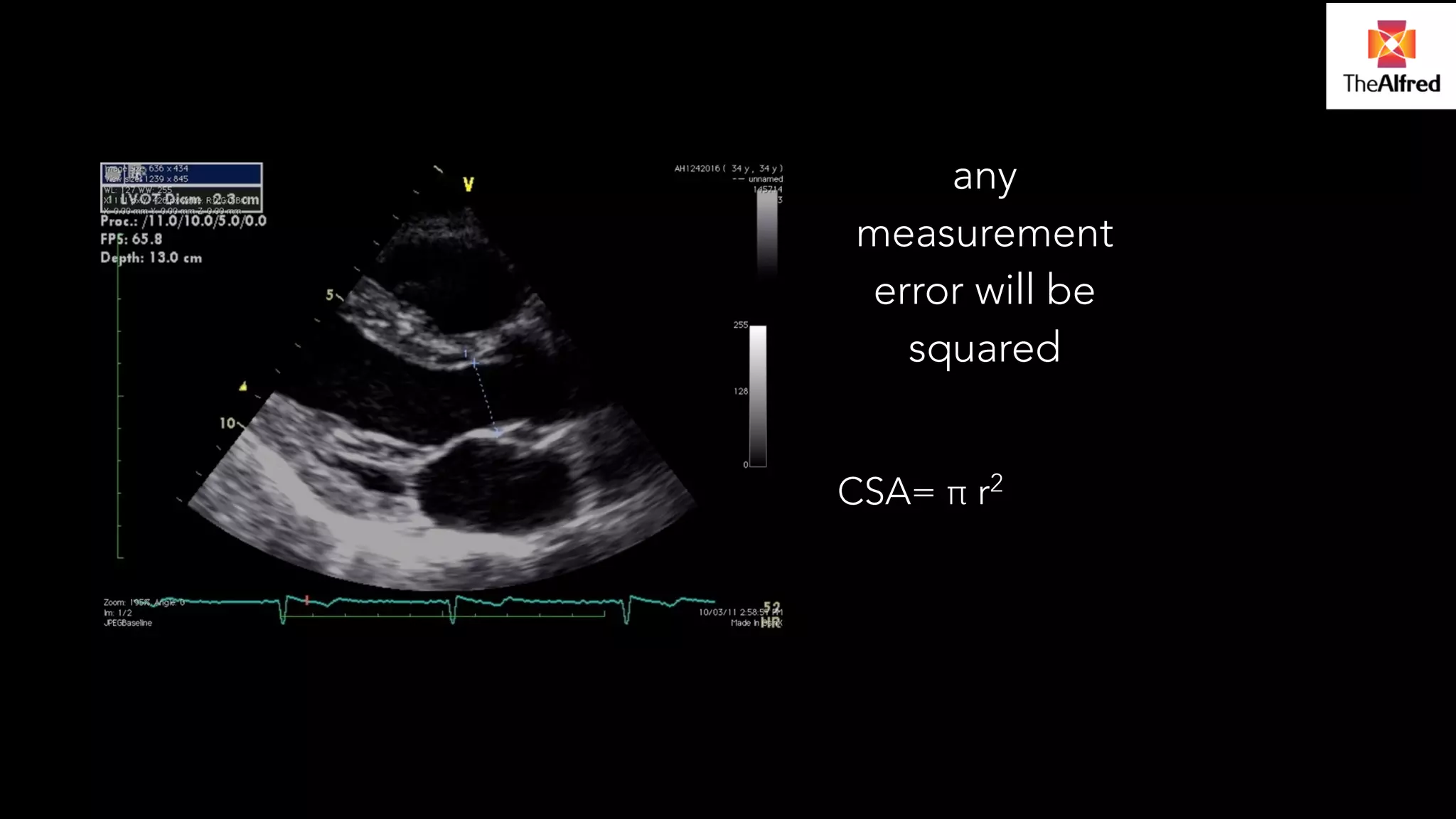 any 
measurement 
error will be 
squared 
! 
CSA= π r2 
 