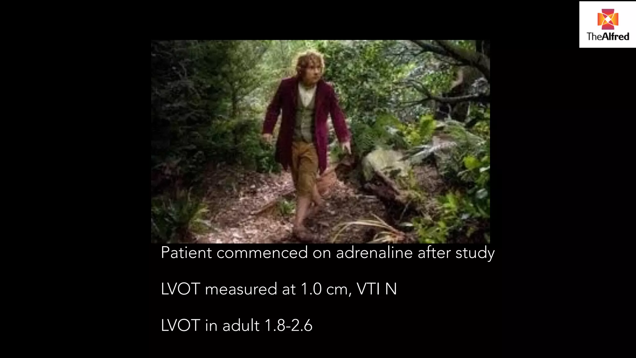Patient commenced on adrenaline after study 
LVOT measured at 1.0 cm, VTI N 
LVOT in adult 1.8-2.6 
 