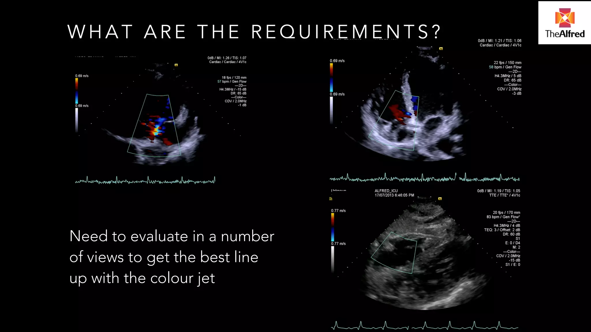 WHAT ARE THE REQUIREMENTS? 
Need to evaluate in a number 
of views to get the best line 
up with the colour jet 
 