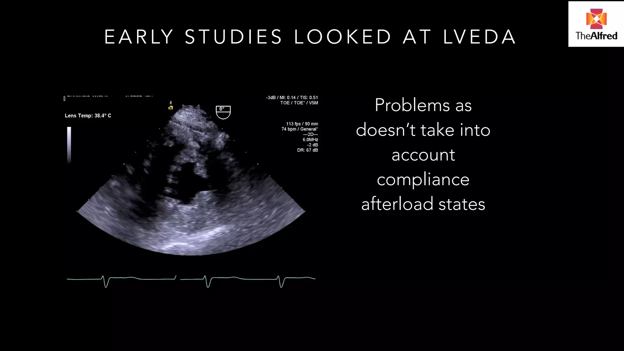 EARLY STUDIES LOOKED AT LVEDA 
Problems as 
doesn’t take into 
account 
compliance 
afterload states 
 