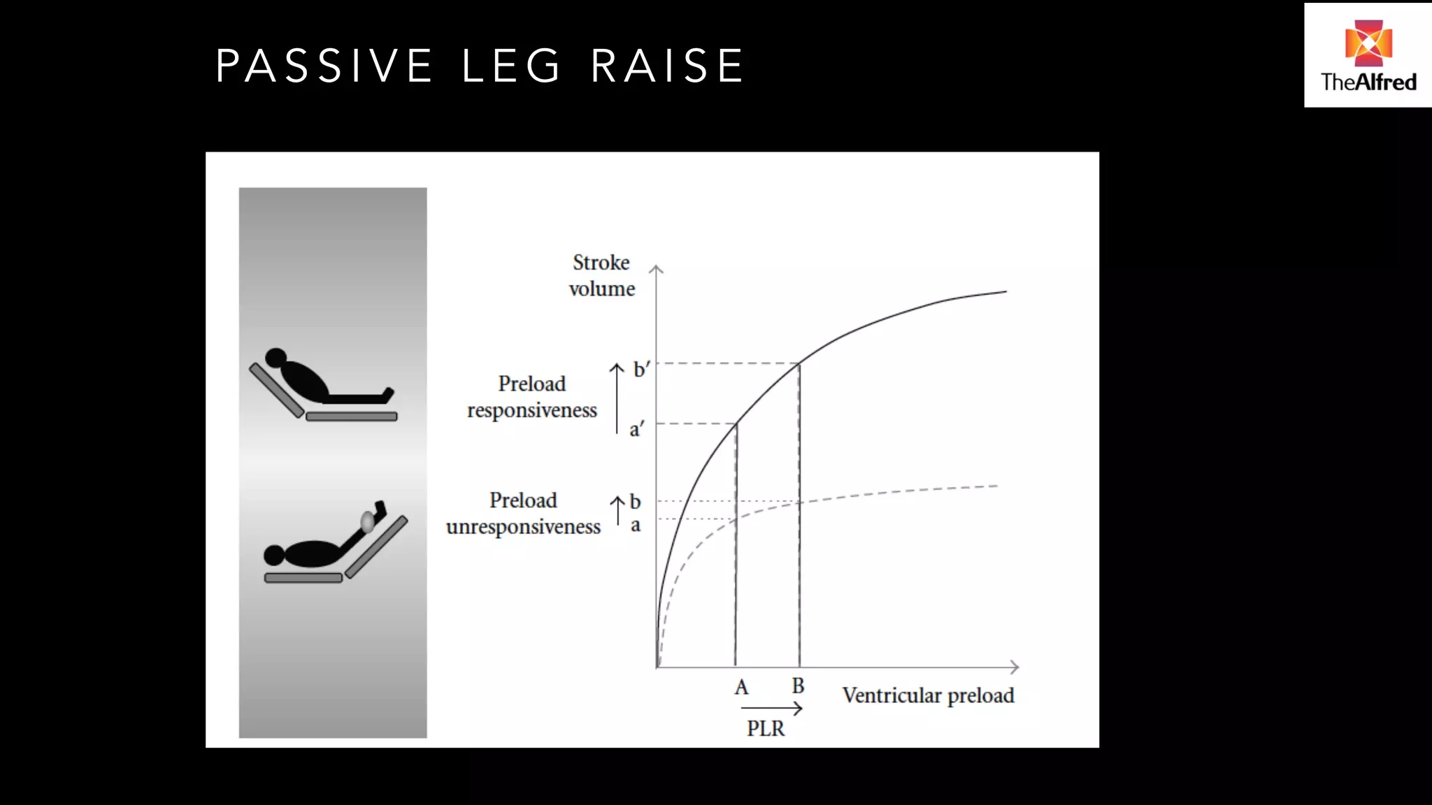 PASSIVE LEG RAISE 
 