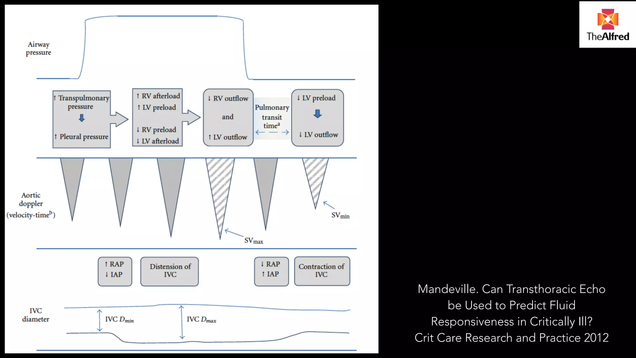 Mandeville. Can Transthoracic Echo 
be Used to Predict Fluid 
Responsiveness in Critically Ill? 
Crit Care Research and Practice 2012 
 