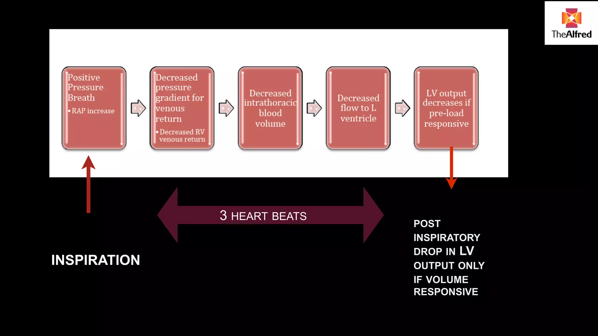 3 HEART BEATS 
INSPIRATION 
POST 
INSPIRATORY 
DROP IN LV 
OUTPUT ONLY 
IF VOLUME 
RESPONSIVE 
 