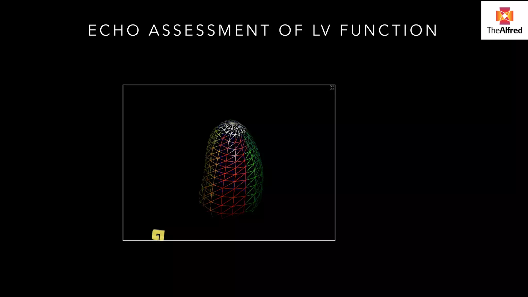 ECHO ASSESSMENT OF LV FUNCTION 
 