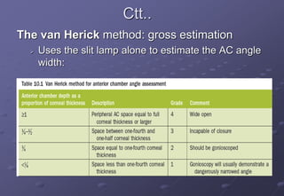 Ctt..
The van Herick method: gross estimation
 Uses the slit lamp alone to estimate the AC angle
width:
 