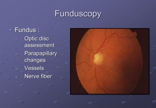 Funduscopy
• Fundus :
1. Optic disc
assessment
2. Parapapillary
changes
3. Vessels
4. Nerve fiber
 