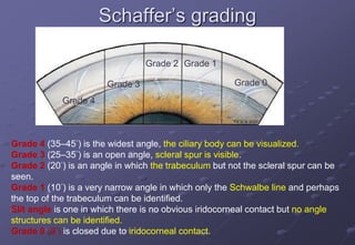 Schaffer’s grading
Grade 0
Grade 1
Grade 2
Grade 3
Grade 4
Grade 4 (35–45°) is the widest angle, the ciliary body can be visualized.
Grade 3 (25–35°) is an open angle, scleral spur is visible.
Grade 2 (20°) is an angle in which the trabeculum but not the scleral spur can be
seen.
Grade 1 (10°) is a very narrow angle in which only the Schwalbe line and perhaps
the top of the trabeculum can be identified.
Slit angle is one in which there is no obvious iridocorneal contact but no angle
structures can be identified.
Grade 0 (0°) is closed due to iridocorneal contact.
 