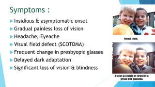 Symptoms :
 Insidious & asymptomatic onset
 Gradual painless loss of vision
 Headache, Eyeache
 Visual field defect (SCOTOMA)
 Frequent change in presbyopic glasses
 Delayed dark adaptation
 Significant loss of vision & blindness
 