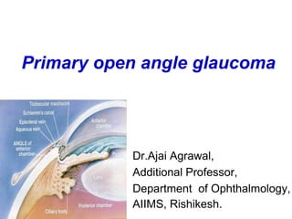 Primary open angle glaucoma
Dr.Ajai Agrawal,
Additional Professor,
Department of Ophthalmology,
AIIMS, Rishikesh.
 
