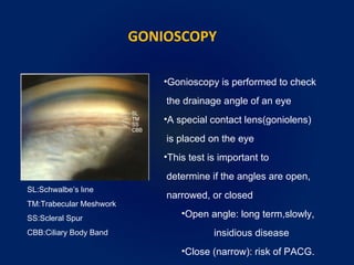 GONIOSCOPY
SL:Schwalbe’s lıne
TM:Trabecular Meshwork
SS:Scleral Spur
CBB:Ciliary Body Band
•Gonioscopy is performed to check
the drainage angle of an eye
•A special contact lens(goniolens)
is placed on the eye
•This test is important to
determine if the angles are open,
narrowed, or closed
•Open angle: long term,slowly,
insidious disease
•Close (narrow): risk of PACG.
 