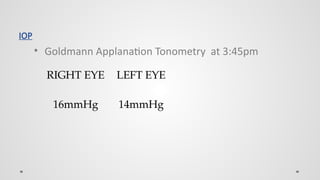 Poag case.pptx for ophthalmology post graduate students on glaucoma ...