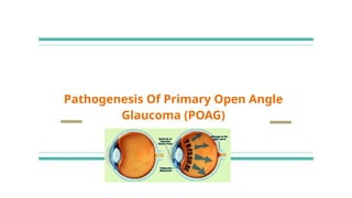 POAG Pathophysiology .pptx