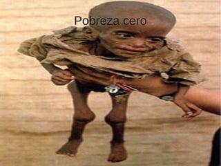 Pobreza cero
 