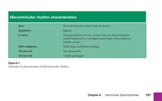Chapter 6 Ventricular Dysrhythmias 101
Idioventricular rhythm characteristics
Rate: 20 to 40 beats per minute (may be slower)
Regularity: Regular
P waves: Not preceded by a P wave (if seen, they are dissociated and
would therefore be a 3rd-degree heart block with an idioven-
tricular escape)
QRS complexes: Wide, large, and bizarre looking
PR interval: Not measurable
QT interval: Usually prolonged
Figure 6-7
Summary of characteristics of idioventricular rhythm.
sha19766_cp06.indd 101
sha19766_cp06.indd 101 7/24/06 1:55:31 PM
7/24/06 1:55:31 PM
 