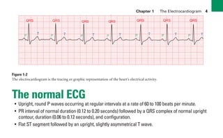 Chapter 1 The Electrocardiogram 4
Figure 1-2
The electrocardiogram is the tracing or graphic representation of the heart’s electrical activity.
The normal ECG
• Upright, round P waves occurring at regular intervals at a rate of 60 to 100 beats per minute.
• PR interval of normal duration (0.12 to 0.20 seconds) followed by a QRS complex of normal upright
contour, duration (0.06 to 0.12 seconds), and configuration.
• Flat ST segment followed by an upright, slightly asymmetrical T wave.
T T T
QRS QRS QRS
P P P
QRS
T T T T
QRS QRS QRS
P P P P
sha19766_cp01.indd 4
sha19766_cp01.indd 4 7/24/06 1:19:43 PM
7/24/06 1:19:43 PM
 