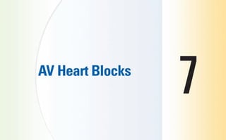 AV Heart Blocks
7
sha19766_cp07.indd 107
sha19766_cp07.indd 107 7/24/06 1:59:48 PM
7/24/06 1:59:48 PM
 