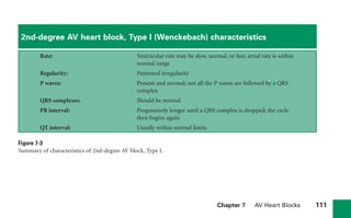 Chapter 7 AV Heart Blocks 111
2nd-degree AV heart block, Type I (Wenckebach) characteristics
Rate: Ventricular rate may be slow, normal, or fast; atrial rate is within
normal range
Regularity: Patterned irregularity
P waves: Present and normal; not all the P waves are followed by a QRS
complex
QRS complexes: Should be normal
PR interval: Progressively longer until a QRS complex is dropped; the cycle
then begins again
QT interval: Usually within normal limits
Figure 7-3
Summary of characteristics of 2nd-degree AV block, Type I.
sha19766_cp07.indd 111
sha19766_cp07.indd 111 7/24/06 1:59:52 PM
7/24/06 1:59:52 PM
 