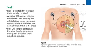Chapter 8 Electrical Axis 122
Lead I
• Lead I is oriented at 0° (located at
the three o’clock position).
• A positive QRS complex indicates
the mean QRS axis is moving from
right to left in a normal manner and
directed somewhere between –90°
and +90° (the right half of the circle).
• If the QRS complex points down
(negative), then the impulses are
moving from left to right; this is
considered abnormal.
Figure 8-4
A positive QRS complex is seen in lead I if the mean QRS axis is
directed anywhere between –90 and +90.
+
+ +
+
+
+
+ +
+
+
+
+
+
+
+
+ +
–
–
–
–
–
–
–
–
– –
– –
+
Right
+90°
Left
–90°
Lead I
– +
QRS
in lead I
AV
node
Mean QRS axis
Left arm electrode
sha19766_cp08.indd 122
sha19766_cp08.indd 122 7/24/06 2:05:48 PM
7/24/06 2:05:48 PM
 