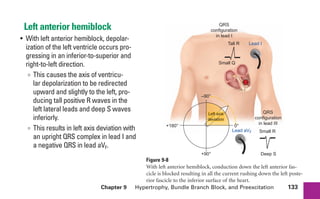 Chapter 9 Hypertrophy, Bundle Branch Block, and Preexcitation 133
Left anterior hemiblock
• With left anterior hemiblock, depolar-
ization of the left ventricle occurs pro-
gressing in an inferior-to-superior and
right-to-left direction.
∞ This causes the axis of ventricu-
lar depolarization to be redirected
upward and slightly to the left, pro-
ducing tall positive R waves in the
left lateral leads and deep S waves
inferiorly.
∞ This results in left axis deviation with
an upright QRS complex in lead I and
a negative QRS in lead aVF.
+
+
Block
Left axis
deviation
Deep S
Small R
QRS
configuration
in lead III
Small Q
QRS
configuration
in lead I
+180° 0°
+90°
–90°
Lead aVF
Lead I
Tall R
Figure 9-8
With left anterior hemiblock, conduction down the left anterior fas-
cicle is blocked resulting in all the current rushing down the left poste-
rior fascicle to the inferior surface of the heart.
sha19766_cp09.indd 133
sha19766_cp09.indd 133 7/24/06 2:10:02 PM
7/24/06 2:10:02 PM
 