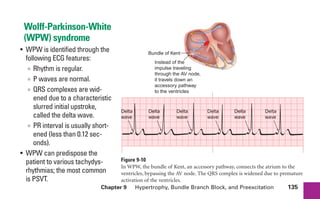 Chapter 9 Hypertrophy, Bundle Branch Block, and Preexcitation 135
Wolff-Parkinson-White
(WPW) syndrome
• WPW is identified through the
following ECG features:
∞ Rhythm is regular.
∞ P waves are normal.
∞ QRS complexes are wid-
ened due to a characteristic
slurred initial upstroke,
called the delta wave.
∞ PR interval is usually short-
ened (less than 0.12 sec-
onds).
• WPW can predispose the
patient to various tachydys-
rhythmias; the most common
is PSVT.
Figure 9-10
In WPW, the bundle of Kent, an accessory pathway, connects the atrium to the
ventricles, bypassing the AV node. The QRS complex is widened due to premature
activation of the ventricles.
Instead of the
impulse traveling
through the AV node,
it travels down an
accessory pathway
to the ventricles
Bundle of Kent
Delta
wave
Delta
wave
Delta
wave
Delta
wave
Delta
wave
Delta
wave
sha19766_cp09.indd 135
sha19766_cp09.indd 135 7/24/06 2:10:03 PM
7/24/06 2:10:03 PM
 
