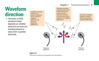 Chapter 1 The Electrocardiogram 8
Waveform
direction
• Direction an ECG
waveform takes
depends on whether
electrical currents are
traveling toward or
away from a positive
electrode.
Impulses traveling
perpendicular to the
positive electrode
may produce a
biphasic waveform
(one that has both a
positive and negative
deflection).
Positive
electrode
Negative
electrode
– +
Impulses traveling
toward a positive
electrode produce
upward deflections.
Impulses traveling
away from a
positive electrode
and/or toward a
negative
electrode will
produce
downward
deflections.
Figure 1-5
Direction of electrical impulses and waveforms.
sha19766_cp01.indd 8
sha19766_cp01.indd 8 7/24/06 1:19:43 PM
7/24/06 1:19:43 PM
 