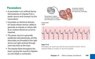Chapter 11 Other Cardiac Conditions 149
Pacemakers
• A pacemaker is an artificial device
that produces an impulse from a
power source and conveys it to the
myocardium.
• It provides an electrical stimulus
for hearts whose intrinsic ability to
generate an impulse or whose abil-
ity to conduct electrical current is
impaired.
• The power source is generally
positioned subcutaneously, and the
electrodes are threaded to the right
atrium and right ventricle through
veins that drain to the heart.
• The impulse flows throughout the
heart causing the muscle to depolar-
ize and initiate a contraction.
Figure 11-5
Pacemakers are used to provide electrical stimuli for hearts with an
impaired ability to conduct an electrical impulse.
Impulses initiated
by the SA node do
not reach the ventricles
BLOCKED
Pacemaker initiates
impulses that stimulate
the ventricles to contract
Pacemaker
spike
Pacemaker
sha19766_cp11.indd 149
sha19766_cp11.indd 149 7/24/06 2:39:39 PM
7/24/06 2:39:39 PM
 