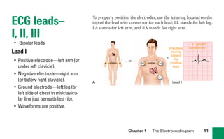 Chapter 1 The Electrocardiogram 11
ECG leads–
I, II, III
• Bipolar leads
Lead I
• Positive electrode—left arm (or
under left clavicle).
• Negative electrode—right arm
(or below right clavicle).
• Ground electrode—left leg (or
left side of chest in midclavicu-
lar line just beneath last rib).
• Waveforms are positive.
RA
LL
+ +
–
–
G
LA
Impulses
moving
toward
the
positive
lead
A Lead I
view view
or
=
= Upright
waveforms
To properly position the electrodes, use the lettering located on the
top of the lead wire connector for each lead; LL stands for left leg,
LA stands for left arm, and RA stands for right arm.
sha19766_cp01.indd 11
sha19766_cp01.indd 11 7/24/06 1:19:44 PM
7/24/06 1:19:44 PM
 