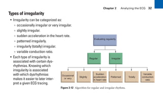 Chapter 2 Analyzing the ECG 32
Regular Irregular
Occasional
or very
Slightly
Sudden
acceleration
in heart rate
Patterned Totally
Variable
conduction
ratio
Evaluating regularity
Types of irregularity
• Irregularity can be categorized as:
∞ occasionally irregular or very irregular.
∞ slightly irregular.
∞ sudden acceleration in the heart rate.
∞ patterned irregularly.
∞ irregularly (totally) irregular.
∞ variable conduction ratio.
Figure 2-12 Algorithm for regular and irregular rhythms.
• Each type of irregularity is
associated with certain dys-
rhythmias. Knowing which
irregularity is associated
with which dysrhythmias
makes it easier to later inter-
pret a given ECG tracing.
sha19766_cp02.indd 32
sha19766_cp02.indd 32 7/24/06 1:48:23 PM
7/24/06 1:48:23 PM
 