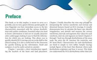 Preface
This book, as its title implies, is meant to serve as a
portable, easy to view, quick reference pocket guide. At
your fingertips you have immediate access to the key
characteristics associated with the various dysrhyth-
mias and cardiac conditions. Essential (what you need
to know) information is laid out in visually attractive
color-coded pages making it easy to find the informa-
tion for which you are looking. This allows you to
quickly identify ECG tracings you see in the field or the
clinical setting. It is also a useful tool in the classroom
for quickly looking up key information. Small and
compact, it can be easily carried in a pocket.
Chapter 1 provides a short introduction regard-
ing the location of the heart and lead placement.
Chapter 2 briefly describes the nine-step process for
interpreting the various waveforms and normal and
abnormal features found on ECG tracings. It visually
demonstrates how to calculate the heart rate, identify
irregularities, and identify and measure the various
waveforms, intervals and segments. Key values for each
waveform, interval, and segment are listed. Chapters 3
through 7 lead you through dysrhythmias of the sinus
node, the atria, the AV junction, the ventricles, and
AV heart block. Characteristics for each dysrhythmia
are listed in simple to view tables. Sample tracings
include figures of the heart that illustrate where each
dysrhythmia originates and how it occurs. This helps
you understand the ECG dysrhythmia rather than just
iv
sha19766_fm.indd iv
sha19766_fm.indd iv 2/28/07 12:09:45 PM
2/28/07 12:09:45 PM
 