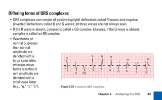 Chapter 2 Analyzing the ECG 43
Differing forms of QRS complexes
• QRS complexes can consist of positive (upright) deflections called R waves and negative
(inverted) deflections called Q and S waves: all three waves are not always seen.
• If the R wave is absent, complex is called a QS complex. Likewise, if the Q wave is absent,
complex is called an RS complex.
• Waveforms of
normal or greater
than normal
amplitude are
denoted with a
large case letter,
whereas wave-
forms less than 5
mm amplitude are
denoted with a
small case letter
(e.g., “q,” “r,” “s”). Figure 2-23 Common QRS complexes.
R
Q
QS
R
q
R
S
q
R
S
R⬘
S
r
S
r⬘
r
R⬘
S
r
Q
r
S
r
sha19766_cp02.indd 43
sha19766_cp02.indd 43 7/24/06 1:48:24 PM
7/24/06 1:48:24 PM
 