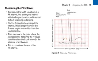 Chapter 2 Analyzing the ECG 46
Measuring the PR interval
• To measure the width (duration) of a
PR interval, first identify the interval
with the longest duration and the most
distinct beginning and ending.
• Start by finding the beginning of the
interval. This is the point where the
P wave begins to transition from the
isoelectric line.
• Then measure to the point where the
isoelectric line (following the P wave)
transitions into the Q or R wave (in the
absence of an S wave).
• This is considered the end of the
PR interval.
Figure 2-26 Measuring PR intervals.
Time (duration, rate)
This PR interval 0.16 seconds in duration
Height/amplitude
(energy)
Start
measurement
here
End
measurement
here
sha19766_cp02.indd 46
sha19766_cp02.indd 46 7/24/06 1:48:24 PM
7/24/06 1:48:24 PM
 
