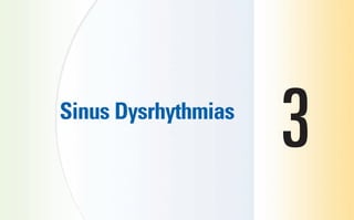 Sinus Dysrhythmias
3
sha19766_cp03.indd 55
sha19766_cp03.indd 55 7/24/06 11:37:10 AM
7/24/06 11:37:10 AM
 