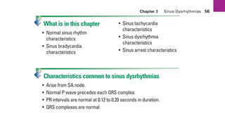 Chapter 3 Sinus Dysrhythmias 56
What is in this chapter
• Normal sinus rhythm
characteristics
• Sinus bradycardia
characteristics
• Sinus tachycardia
characteristics
• Sinus dysrhythmia
characteristics
• Sinus arrest characteristics
Characteristics common to sinus dysrhythmias
• Arise from SA node.
• Normal P wave precedes each QRS complex.
• PR intervals are normal at 0.12 to 0.20 seconds in duration.
• QRS complexes are normal.
sha19766_cp03.indd 56
sha19766_cp03.indd 56 7/24/06 11:37:14 AM
7/24/06 11:37:14 AM
 