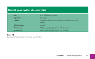 Chapter 3 Sinus Dysrhythmias 57
Figure 3-1
Summary of characteristics of normal sinus rhythm.
Normal sinus rhythm characteristics
Rate: 60 to 100 beats per minute
Regularity: It is regular
P waves: Present and normal; all the P waves are followed by a QRS
complex
QRS complexes: Normal
PR interval: Within normal range (0.12 to 0.20 seconds)
QT interval: Within normal range (0.36 to 0.44 seconds)
sha19766_cp03.indd 57
sha19766_cp03.indd 57 7/24/06 11:37:14 AM
7/24/06 11:37:14 AM
 