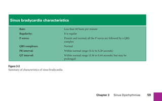 Chapter 3 Sinus Dysrhythmias 59
Sinus bradycardia characteristics
Rate: Less than 60 beats per minute
Regularity: It is regular
P waves: Present and normal; all the P waves are followed by a QRS
complex
QRS complexes: Normal
PR interval: Within normal range (0.12 to 0.20 seconds)
QT interval: Within normal range (0.36 to 0.44 seconds) but may be
prolonged
Figure 3-3
Summary of characteristics of sinus bradycardia.
sha19766_cp03.indd 59
sha19766_cp03.indd 59 7/24/06 11:37:15 AM
7/24/06 11:37:15 AM
 