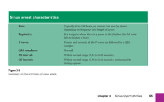 Chapter 3 Sinus Dysrhythmias 65
Sinus arrest characteristics
Rate: Typically 60 to 100 beats per minute, but may be slower
depending on frequency and length of arrest
Regularity: It is irregular where there is a pause in the rhythm (the SA node
fails to initiate a beat)
P waves: Present and normal; all the P waves are followed by a QRS
complex
QRS complexes: Normal
PR interval: Within normal range (0.12 to 0.20 seconds)
QT interval: Within normal range (0.36 to 0.44 seconds); unmeasurable
during a pause
Figure 3-9
Summary of characteristics of sinus arrest.
sha19766_cp03.indd 65
sha19766_cp03.indd 65 7/24/06 11:37:17 AM
7/24/06 11:37:17 AM
 
