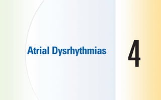 Atrial Dysrhythmias
4
sha19766_cp04.indd 67
sha19766_cp04.indd 67 7/24/06 11:52:53 AM
7/24/06 11:52:53 AM
 