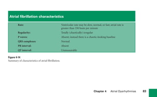 Chapter 4 Atrial Dysrhythmias 83
Atrial fibrillation characteristics
Rate: Ventricular rate may be slow, normal, or fast; atrial rate is
greater than 350 beats per minute
Regularity: Totally (chaotically) irregular
P waves: Absent; instead there is a chaotic-looking baseline
QRS complexes: Normal
PR interval: Absent
QT interval: Unmeasurable
Figure 4-14
Summary of characteristics of atrial fibrillation.
sha19766_cp04.indd 83
sha19766_cp04.indd 83 7/24/06 11:52:59 AM
7/24/06 11:52:59 AM
 