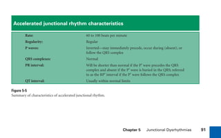Chapter 5 Junctional Dysrhythmias 91
Accelerated junctional rhythm characteristics
Rate: 60 to 100 beats per minute
Regularity: Regular
P waves: Inverted—may immediately precede, occur during (absent), or
follow the QRS complex
QRS complexes: Normal
PR interval: Will be shorter than normal if the P„ wave precedes the QRS
complex and absent if the P„ wave is buried in the QRS; referred
to as the RP„ interval if the P„ wave follows the QRS complex
QT interval: Usually within normal limits
Figure 5-5
Summary of characteristics of accelerated junctional rhythm.
sha19766_cp05.indd 91
sha19766_cp05.indd 91 7/24/06 1:51:32 PM
7/24/06 1:51:32 PM
 