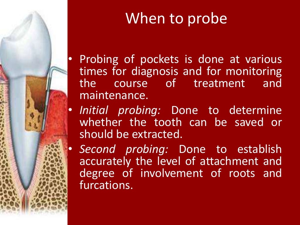 Periodontal Pockets