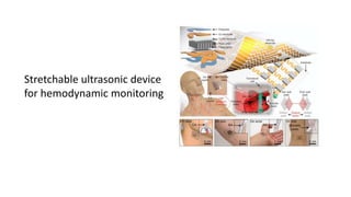 Stretchable ultrasonic device
for hemodynamic monitoring
 