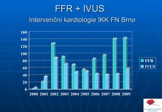FFR + IVUS    Intervenční kardiologie IKK FN Brno 
