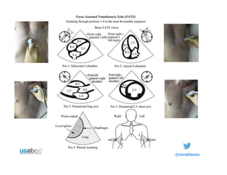 POCUS | PDF
