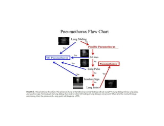 Pocus Modality POCUS | PDF