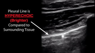 Swbh Map Introduction to POCUS (The Beginning of your journey ) - SWBH POCUS ...