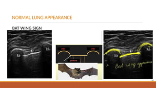 Point of care ultrasound and 2D echocardiography | PPTX