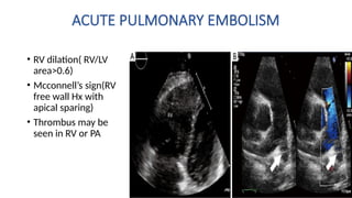 POCUS DYSPNEA Dr.GANESH in trauma lung fields | PPTX