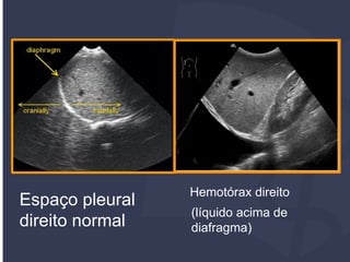 Protocolo FAST POCUS | PDF