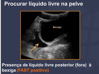 Protocolo FAST POCUS | PDF