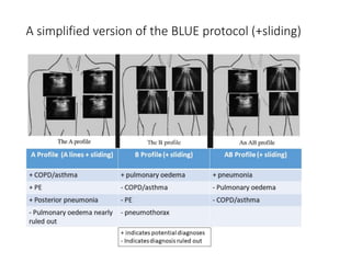 POCUS for dyspnea.pptx